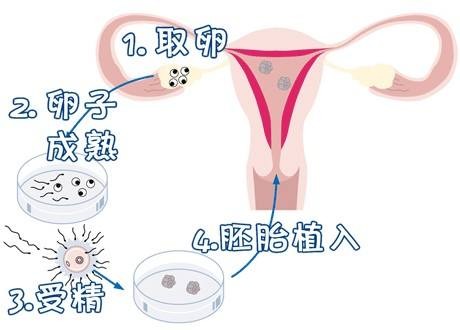 三代试管供卵代怀门诊